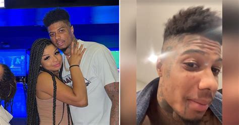 blueface and chrisean fighting|Chrisean Rock Claims Blueface Set Her Up and Punched Her。